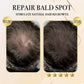 Ginger Hair Regrowth Shampoo Bar 🎁 BUY 1 GET 1 FREE 🎁