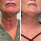 Final Sale Alert: Save 70% Today - ✨ Botox Facial Serum